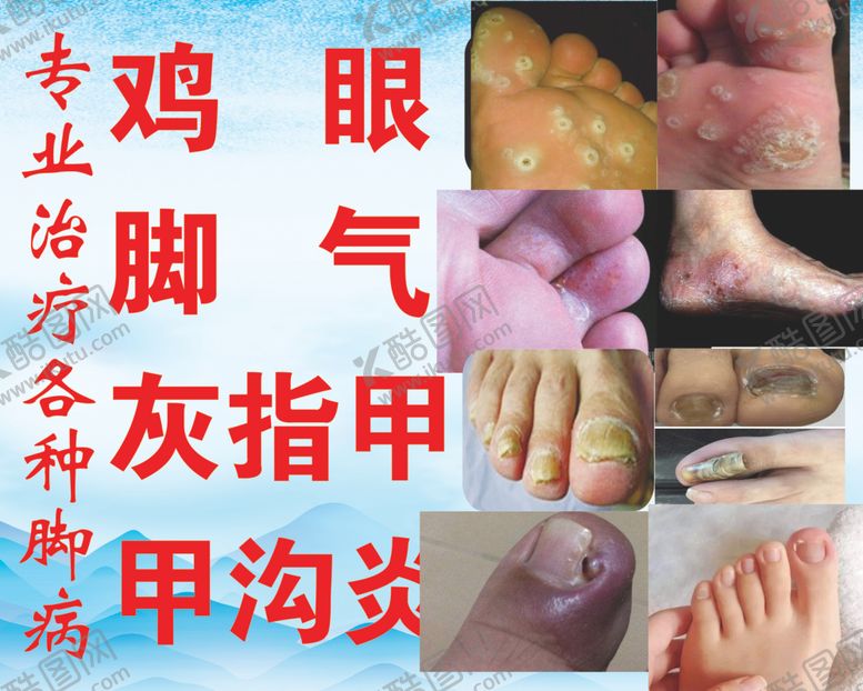 编号：62658304220020317760【酷图网】源文件下载-脚部疾病喷布