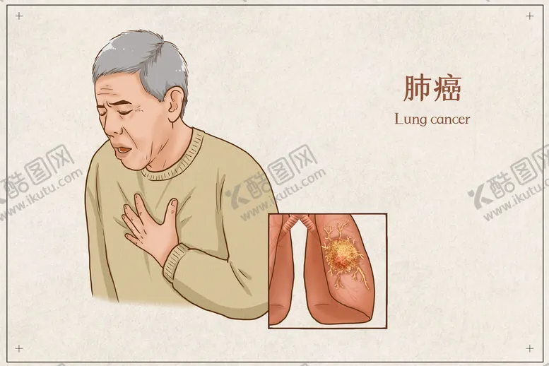 编号：30756810080918270349【酷图网】源文件下载-肺癌