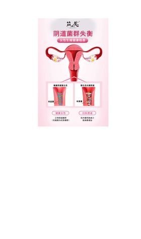 女性生殖保养宣传折页
