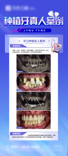 口腔/种植牙案例专家海报