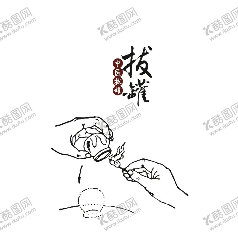 编号：13661707121949045495【酷图网】源文件下载-拔罐