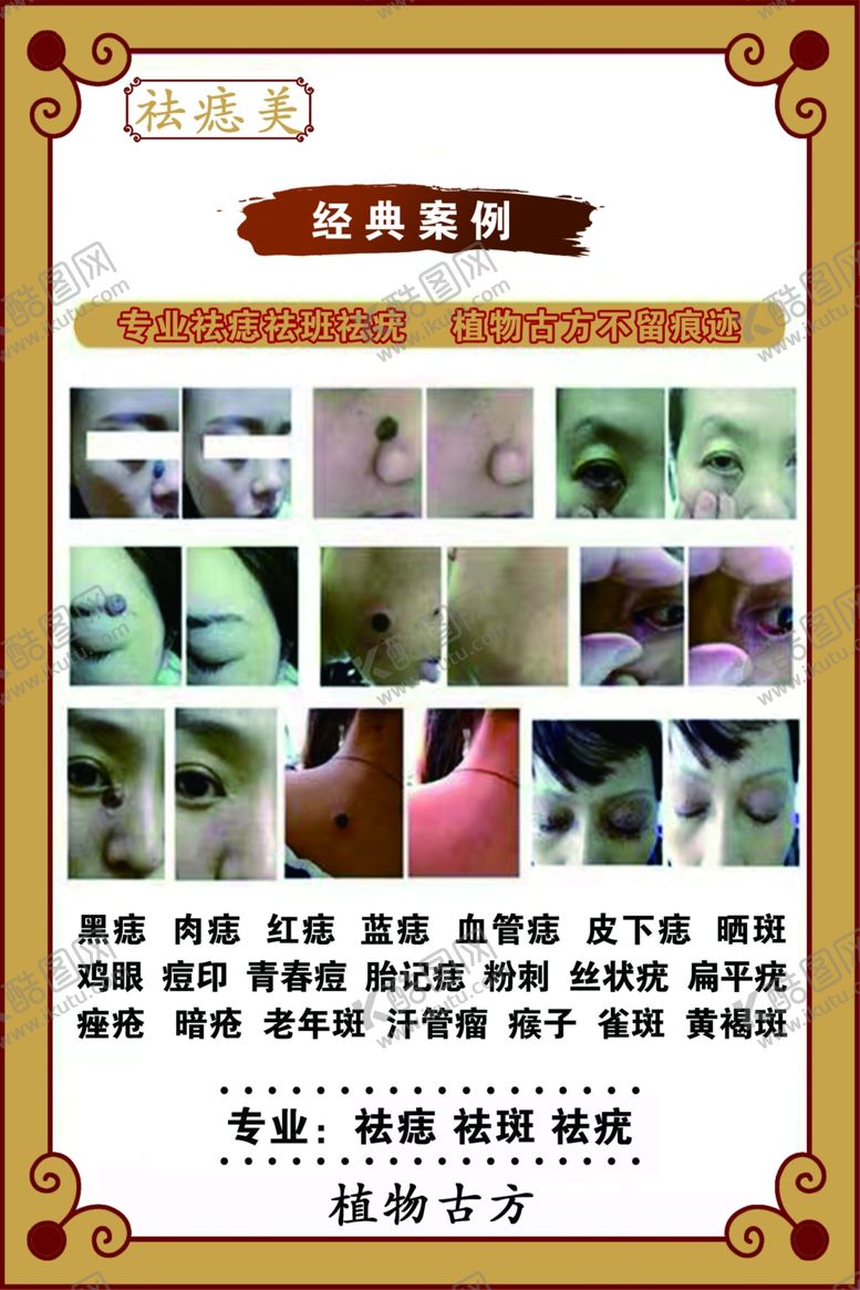 编号：52121101240203593630【酷图网】源文件下载-祛痣祛疣案例对比图
