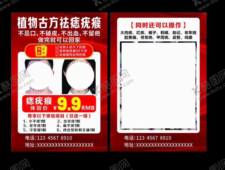 编号：29190604160055156292【酷图网】源文件下载-祛痣宣传单