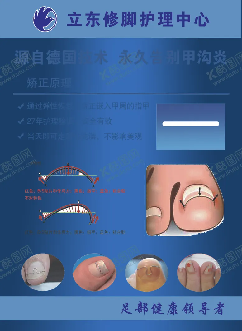 编号：25603509120851378695【酷图网】源文件下载-甲沟炎修脚