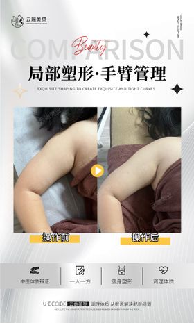 医美手臂管理案例对比海报