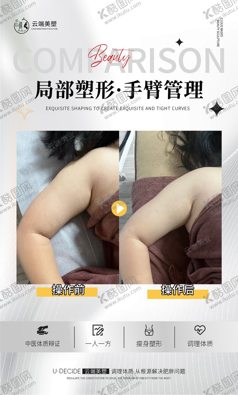 编号：16079607222238456281【酷图网】源文件下载-医美手臂管理案例对比海报