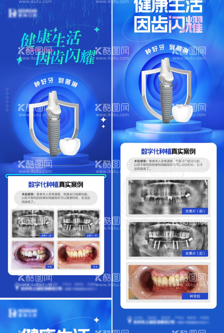 编号：88514211242038047185【酷图网】源文件下载-口腔种植牙海报