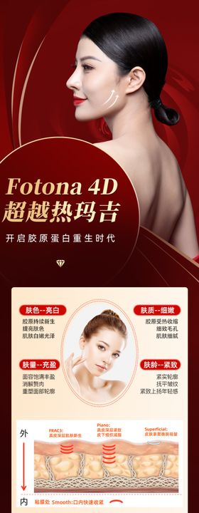 Fotona4D抗衰