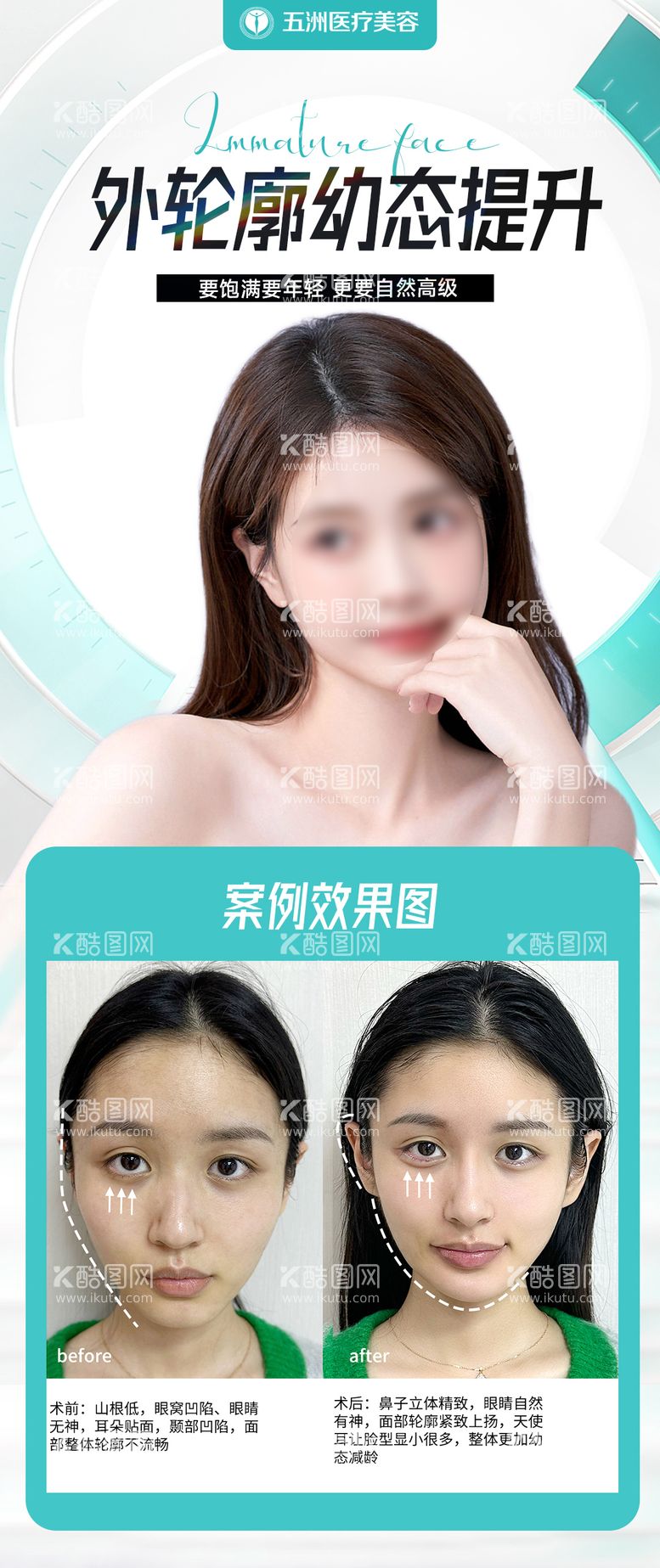 编号：62722811200013372609【酷图网】源文件下载-医美案例海报