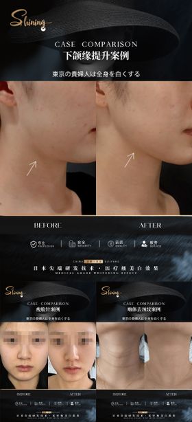 轻医美头像黑金系列海报