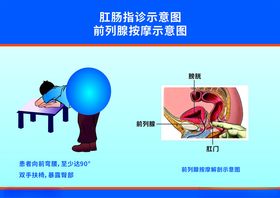 前列腺按摩示意图