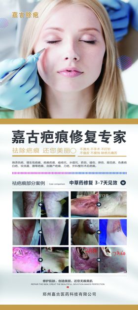 疤痕修复