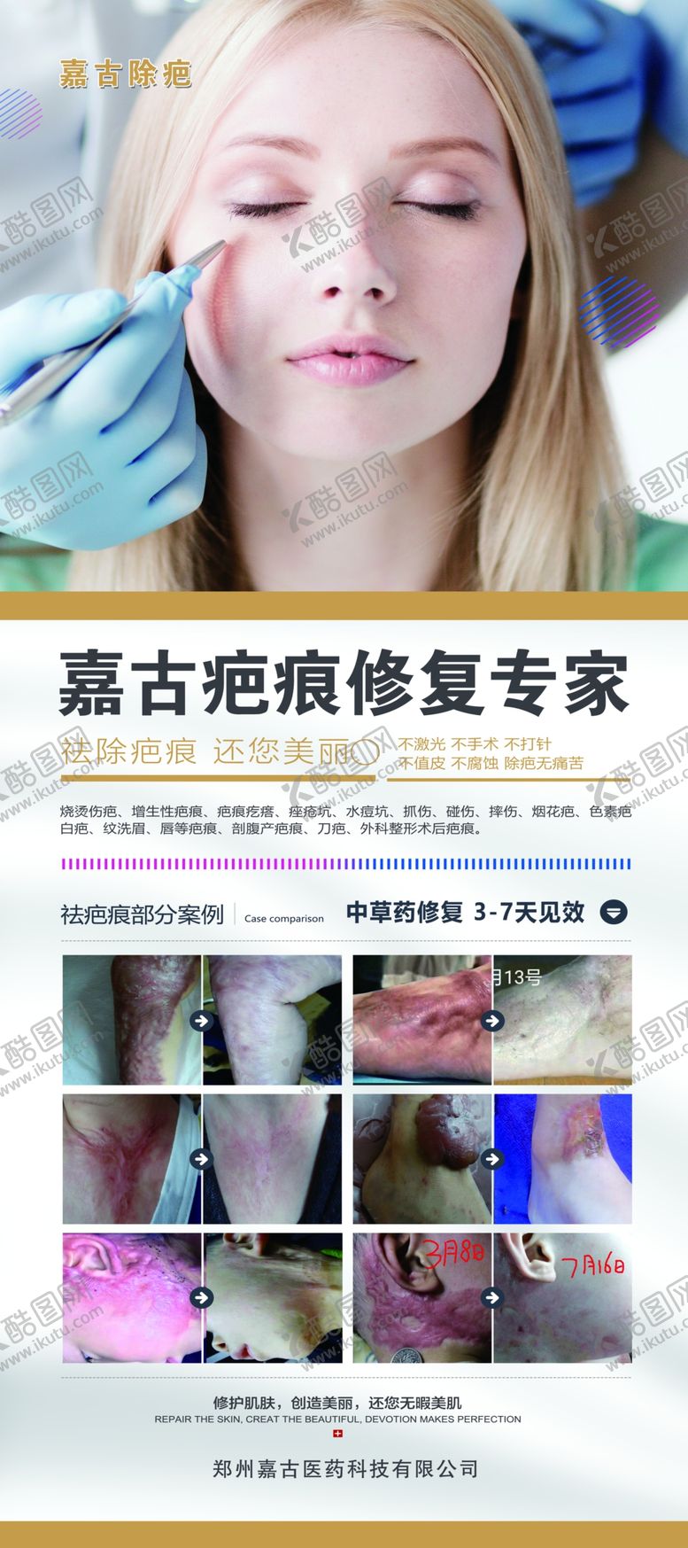 编号：11875409220420165984【酷图网】源文件下载-疤痕修复