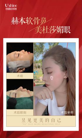 医美整形医院案例对比海报
