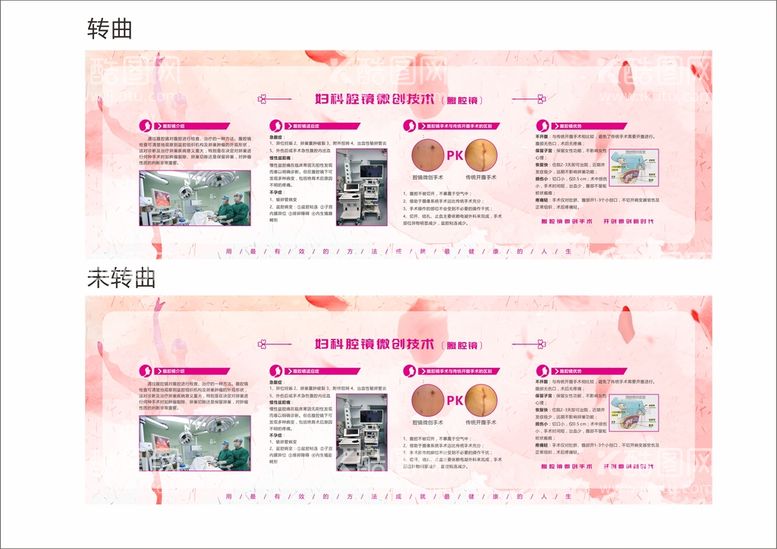 编号：53470011300720044114【酷图网】源文件下载-妇科腔镜微创技术腹腔镜