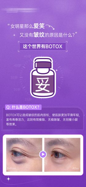 botox科普型朋友圈