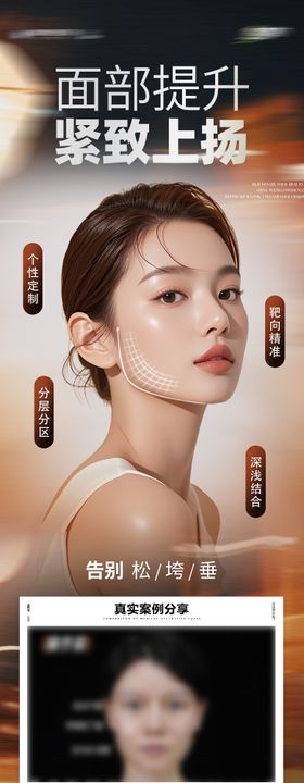 医美面部提升抗衰年轻化案例创意海报