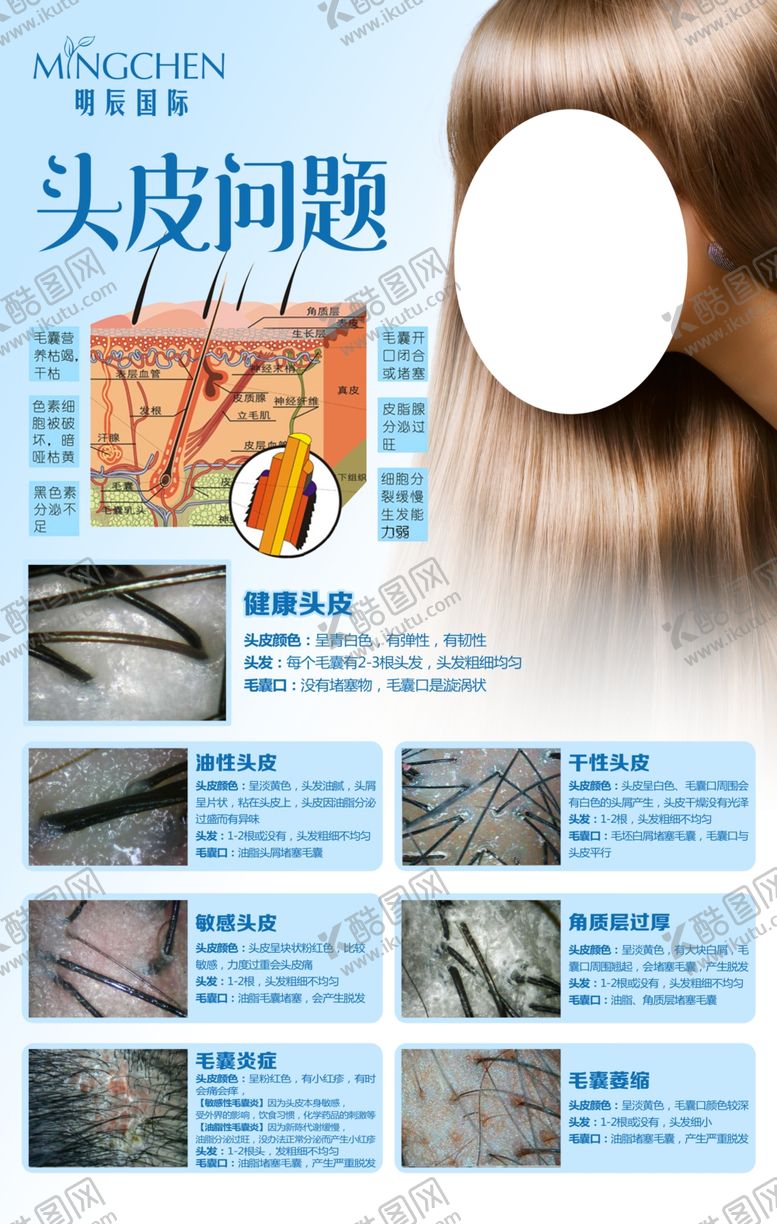 编号：23700204210917287907【酷图网】源文件下载-头皮问题