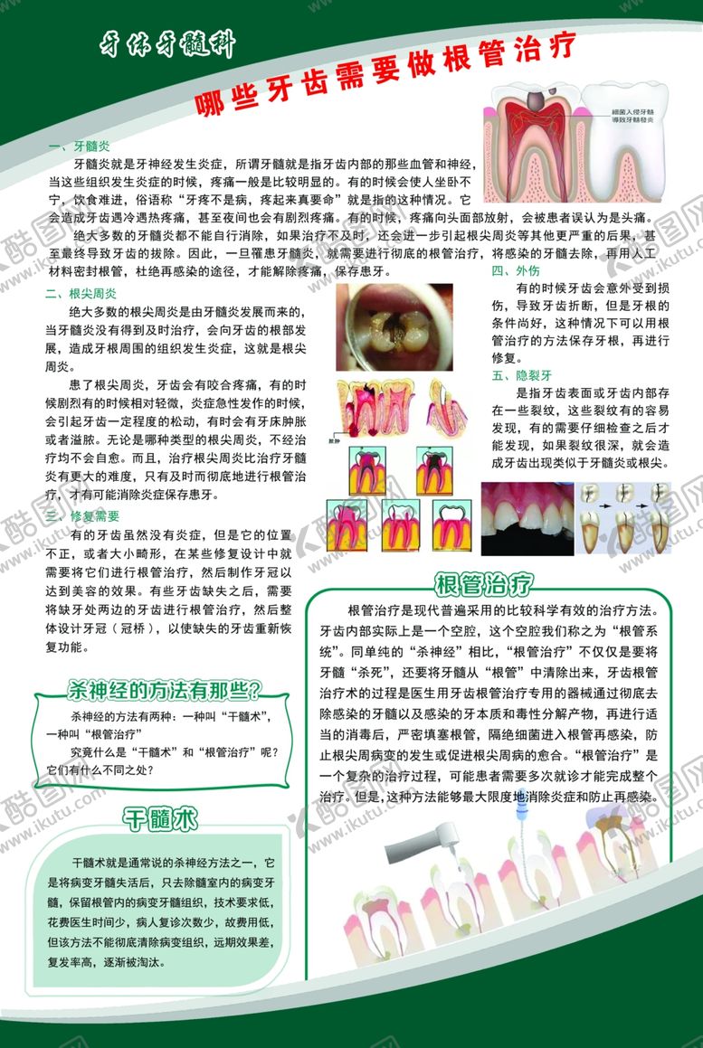 编号：49724809082218327220【酷图网】源文件下载-哪些牙齿需要做根管治疗