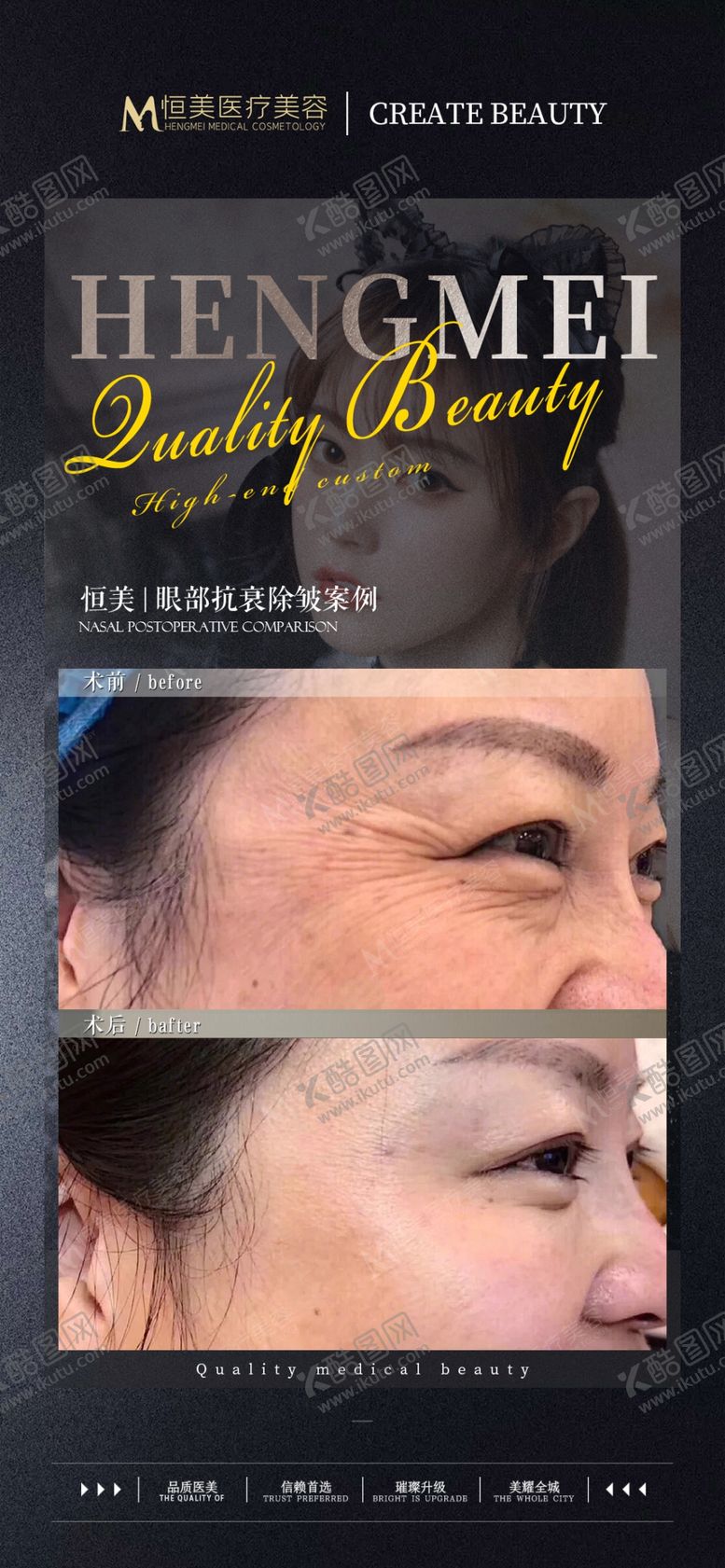 编号：31367001230010349138【酷图网】源文件下载-医美案例对比