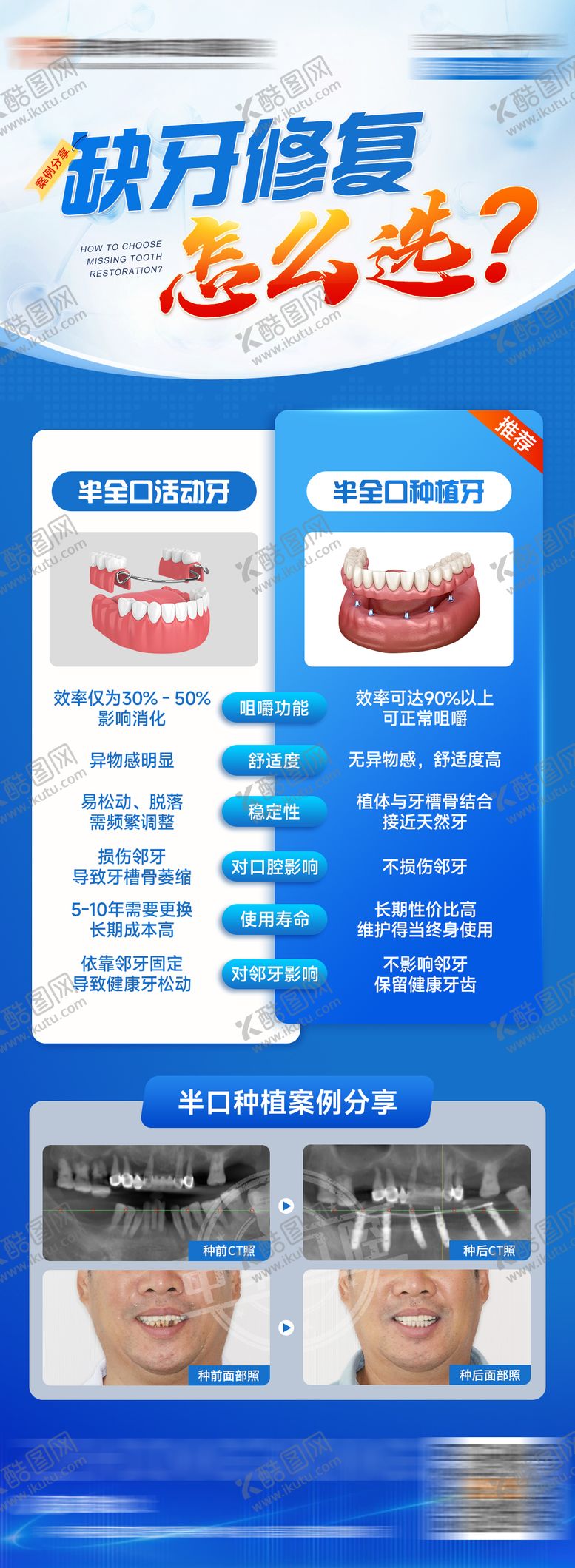 编号：43242911041914336581【酷图网】源文件下载-缺牙修复怎么选海报