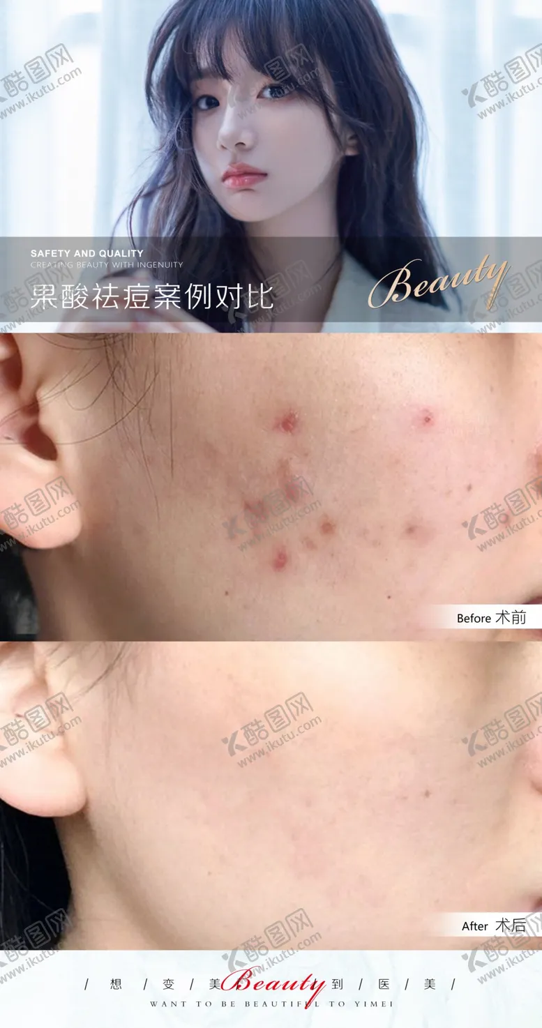 编号：30569209221512048567【酷图网】源文件下载-医美案例模板