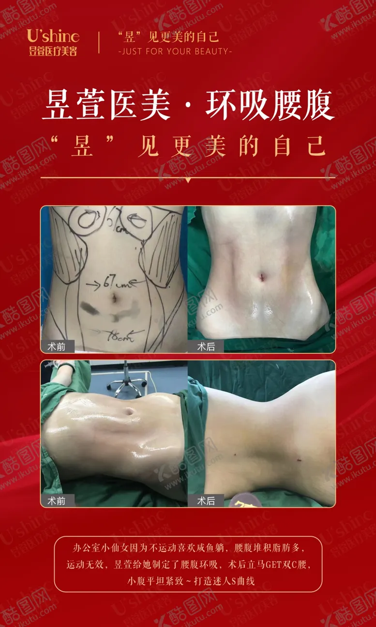 编号：18953806261255392559【酷图网】源文件下载-医美整形医院案例对比海报