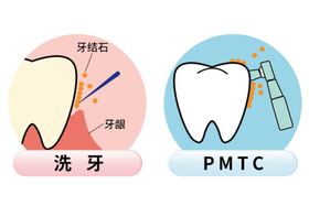 插画牙齿洗牙