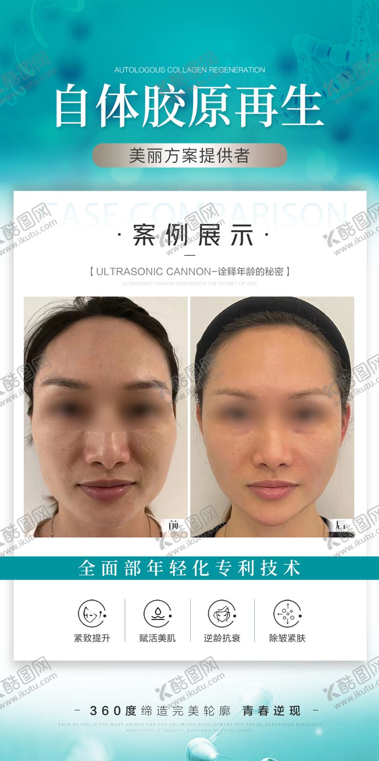 编号：47967508201341577060【酷图网】源文件下载-医美案例海报