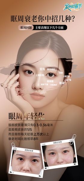 眼周抗衰海报