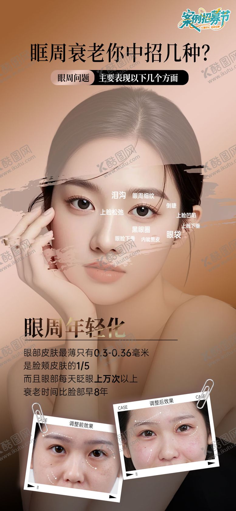 编号：98043608051650064076【酷图网】源文件下载-眼周抗衰海报