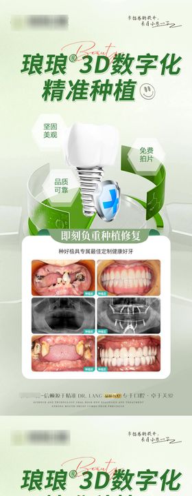 种植口腔专家案例海报长图