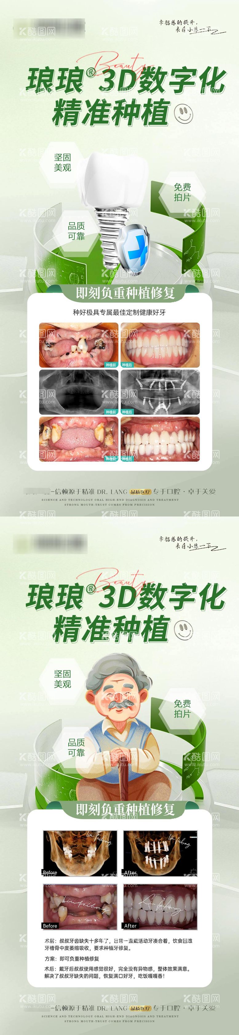 编号：40229011290219384938【酷图网】源文件下载-口腔案例种植牙海报