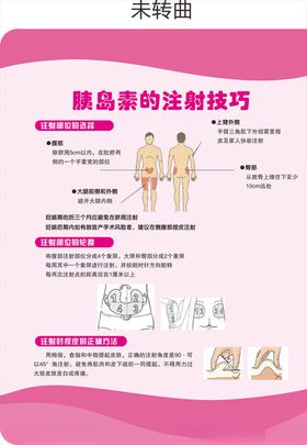 胰岛素的注射技巧