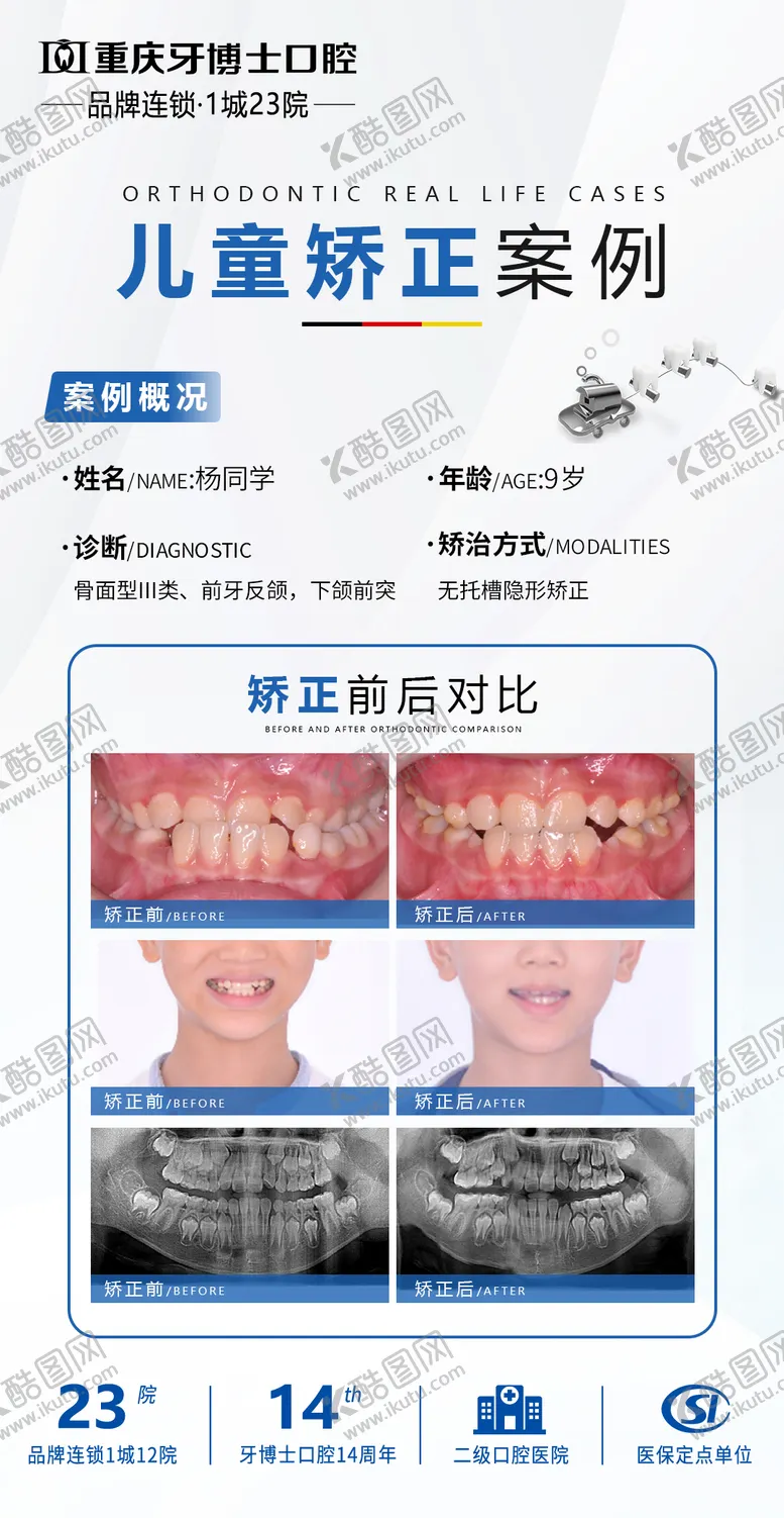 编号：28297507021429029092【酷图网】源文件下载-口腔正畸案例海报