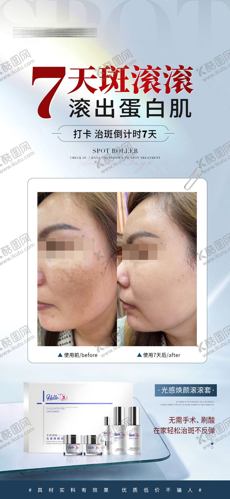 编号：34487409302213145606【酷图网】源文件下载-医美美业淡斑对比海报