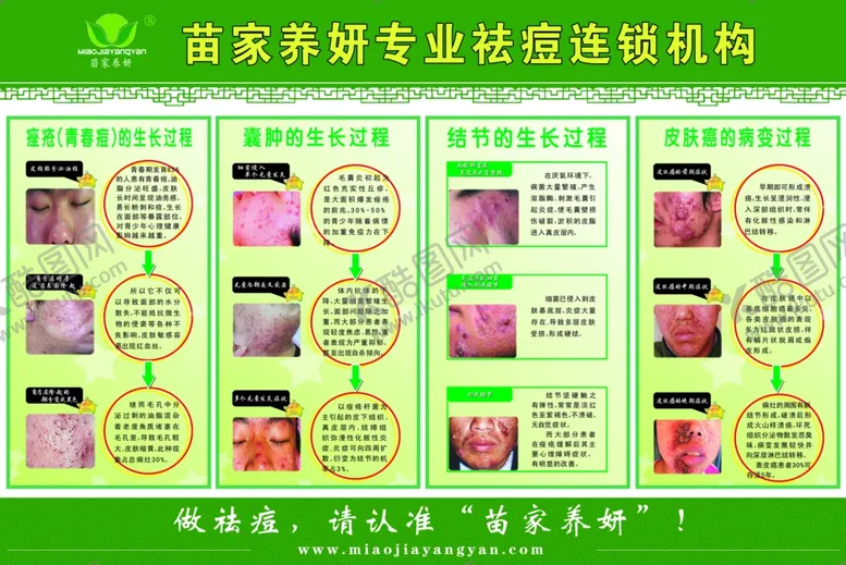 编号：45329804150344562360【酷图网】源文件下载-青春痘的生长过程