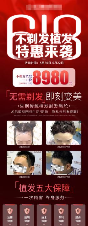 医美618植发活动海报