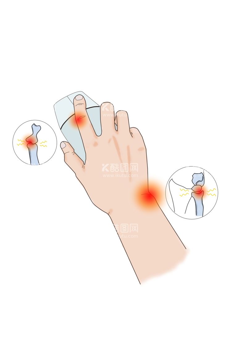 编号：47950012081853349684【酷图网】源文件下载-手部疾病骨痛风湿病内风湿