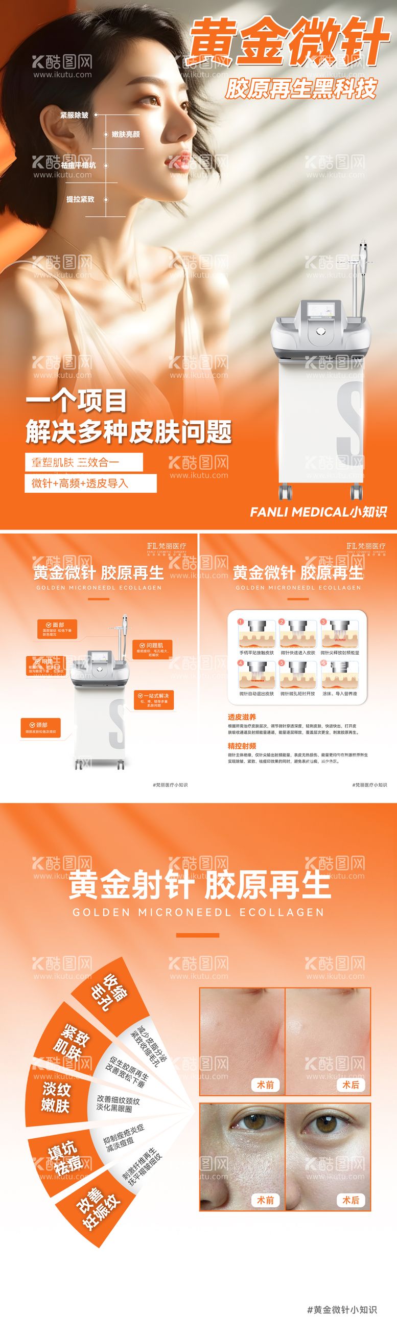 编号：89254712051815204372【酷图网】源文件下载-黄金微针小红书医美仪器介绍海报