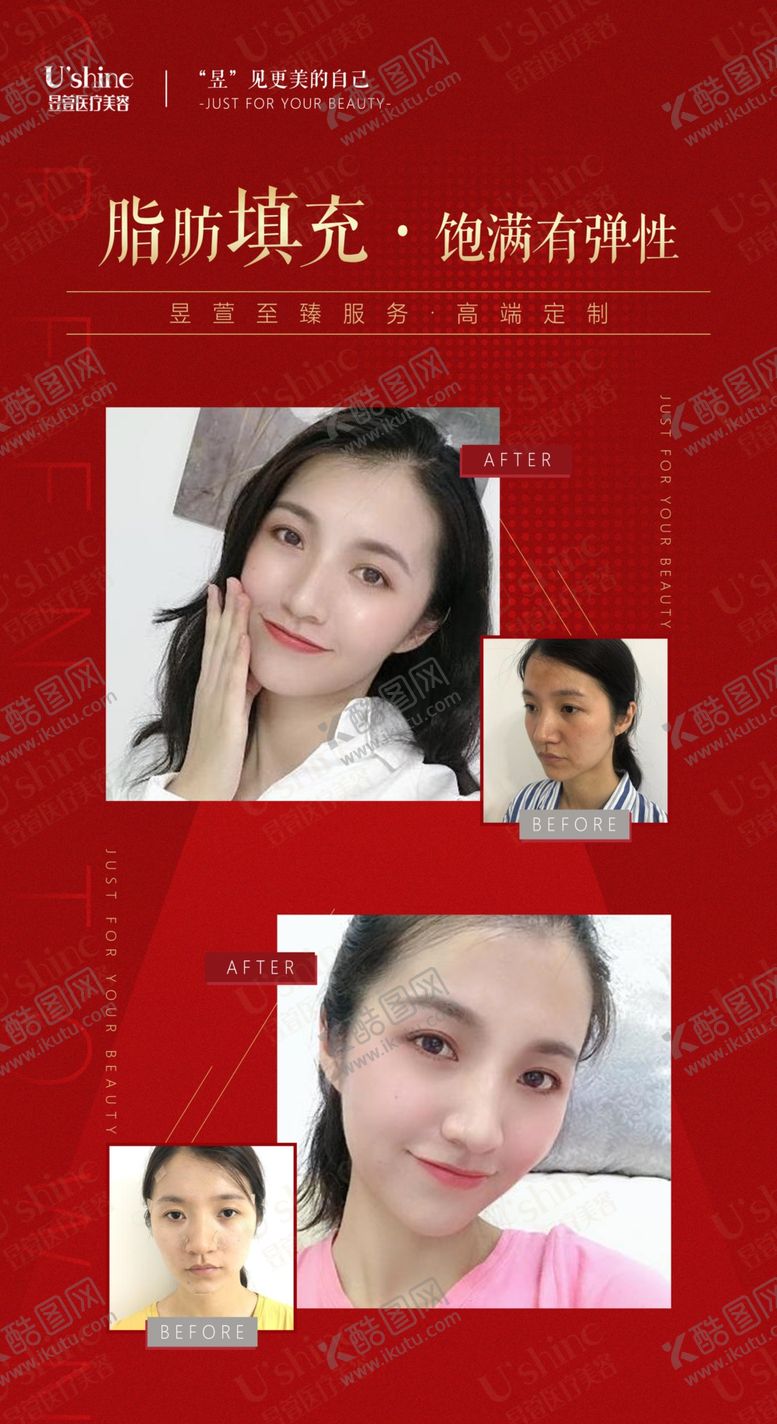 编号：50789309210129119550【酷图网】源文件下载-医美整形医院案例对比海报