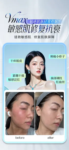 敏感肌修复