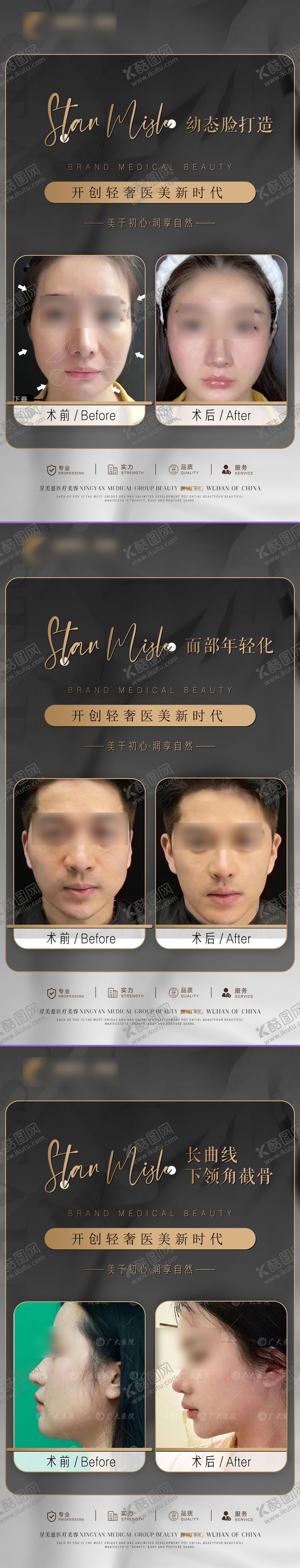 编号：39461201122006554122【酷图网】源文件下载-医美轻奢案例系列海报