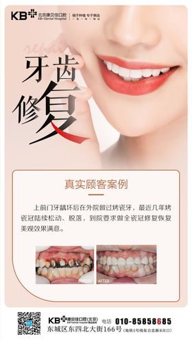 牙齿修复案例海报