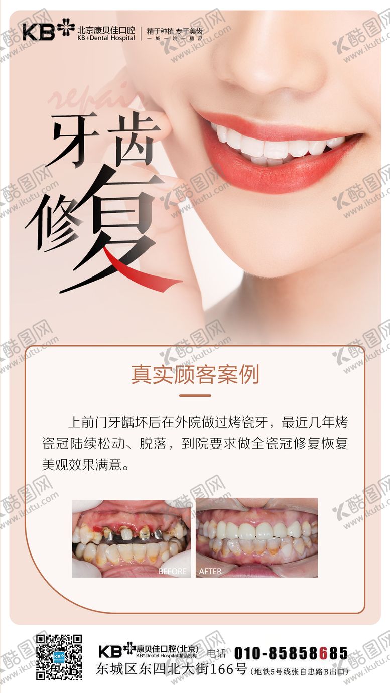 编号：10306505010514061744【酷图网】源文件下载-牙齿修复案例海报