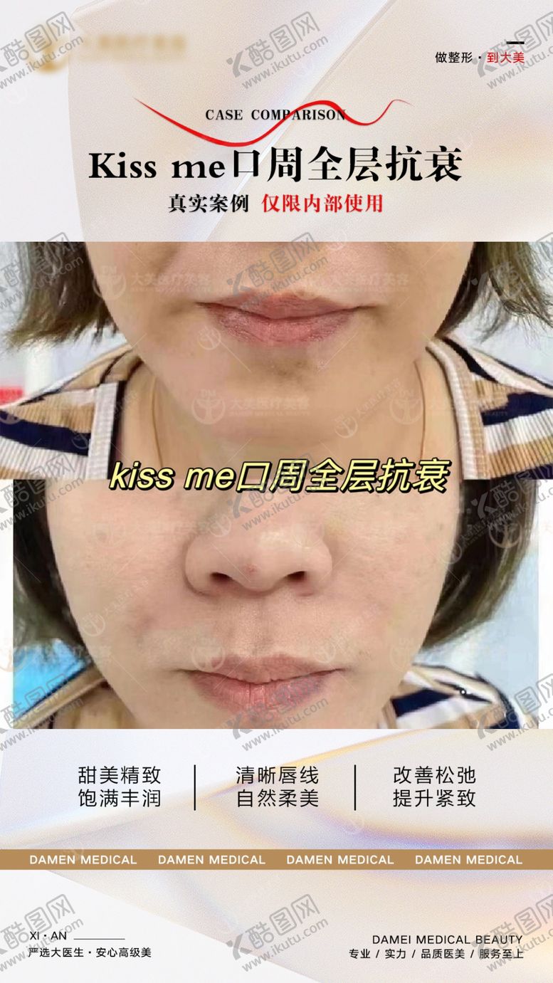 编号：69555801190453249089【酷图网】源文件下载-医美案例对比