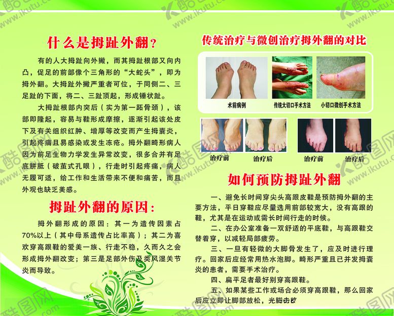 编号：20172506251647158480【酷图网】源文件下载-什么是拇指翻？
