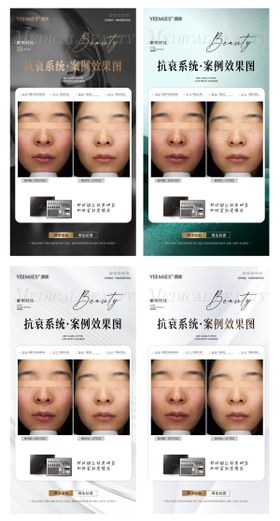 医美美业护肤案例前后对比海报