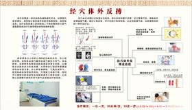 经穴体外反搏
