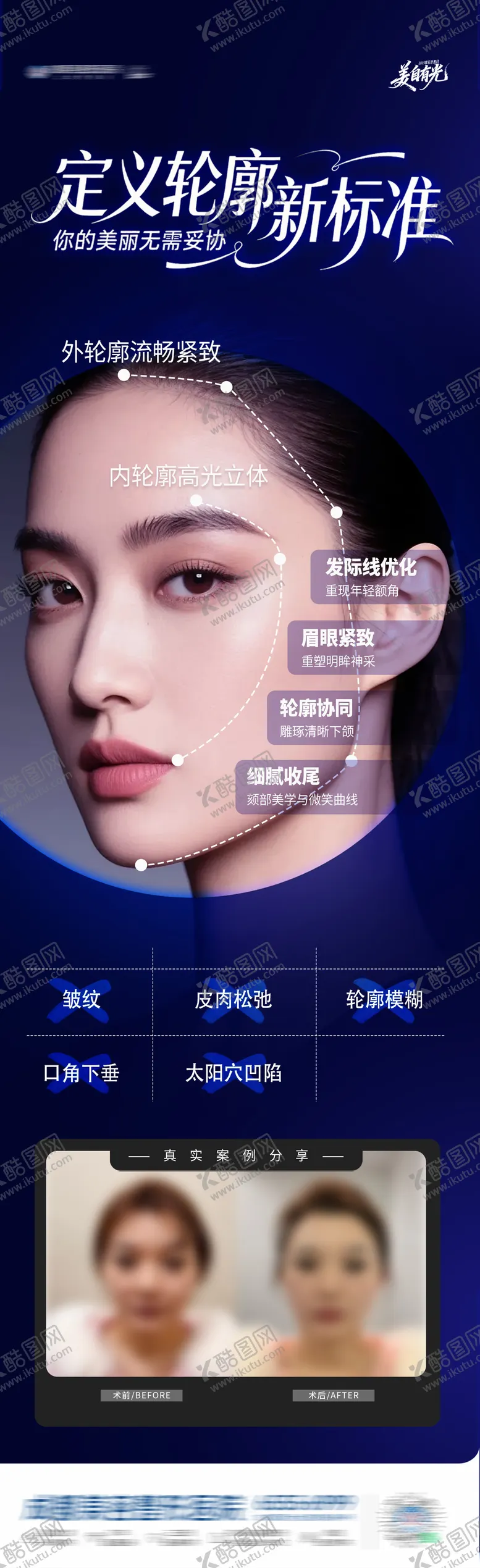 编号：29157404271718575710【酷图网】源文件下载-医美内外轮廓全面部提升案例创意海报
